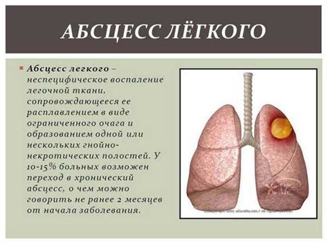 Последствия вирусного воспаления легких