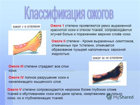 Последствия и осложнения при ожогах II степени с образованием пузырей
