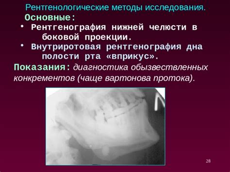 Потеря вставной челюсти: основные причины исследования