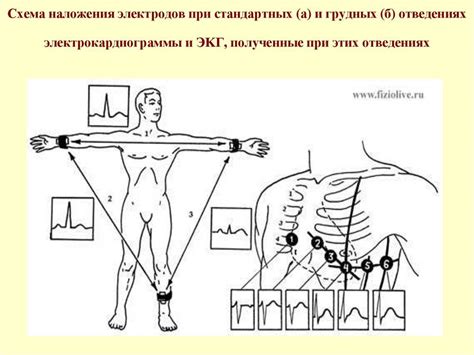 Почему ЭКГ важна для маленьких пациентов и как она помогает в выявлении заболеваний