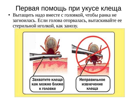 Правила обеспечения безопасности при Каждение клеща на кожу