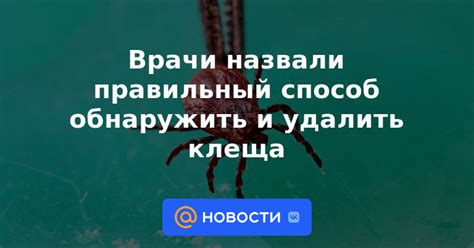 Правильный способ обнаружить символ денежного знака валюты