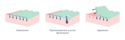 Предварительная подготовка перед процедурой удаления волос воском: несколько важных шагов