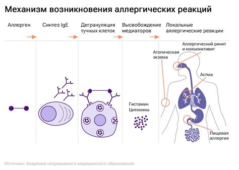 Предотвращение возникновения аллергических реакций во время процедуры введения вакцины