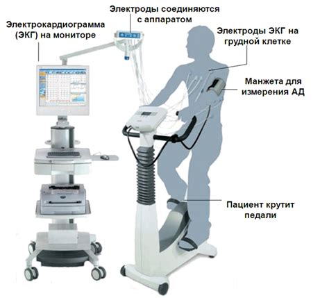 Преимущества и ограничения проведения ЭКГ с физической нагрузкой