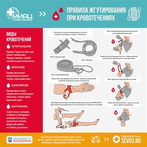 Прекратите кровь: действия при кровотечении с места происшествия