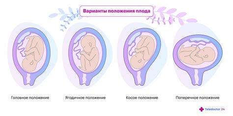 Признаки, указывающие на головное предлежание