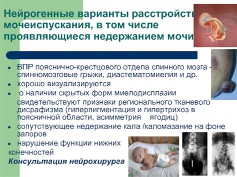 Признаки изменений функции мочеиспускания