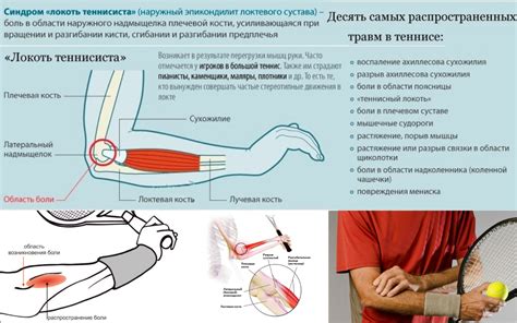 Признаки и проявления повреждения локтевого сустава