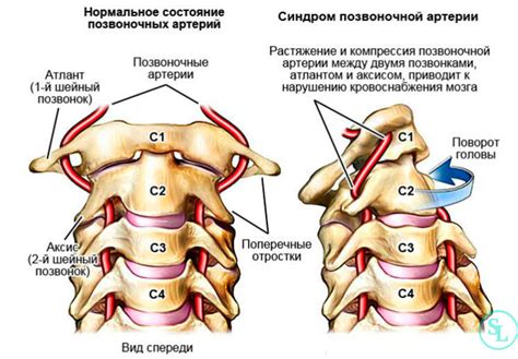 Признаки симптомов нарушения нормального состояния шеи