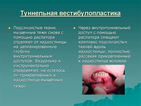 Примерное питание для восстановления после операции в полости рта