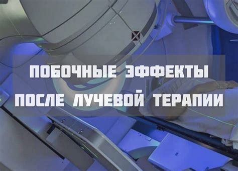 Принцип действия лучевой терапии и его влияние на организм пациента