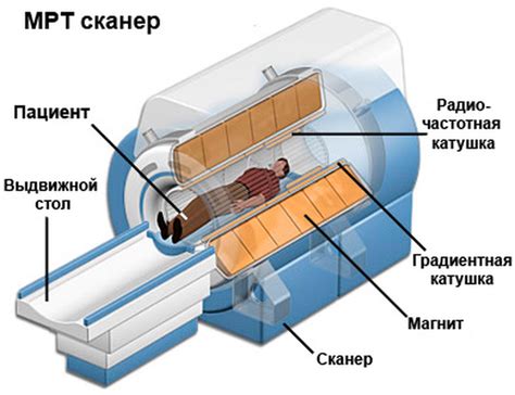 Принцип работы и возможности электронейромиографии