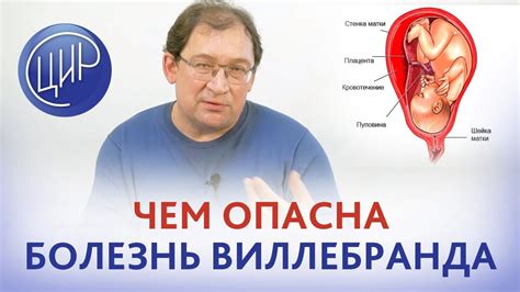 Причины Виллебранда болезни у женщин