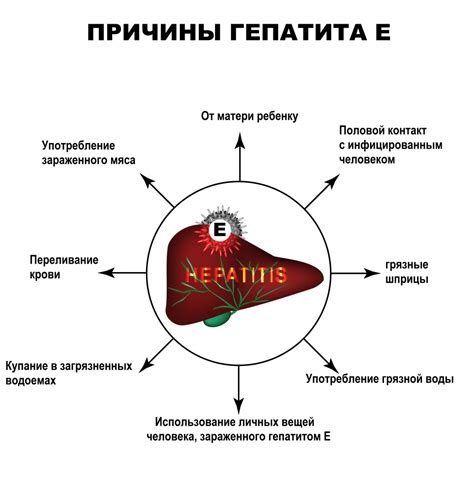 Причины возникновения гепатита C