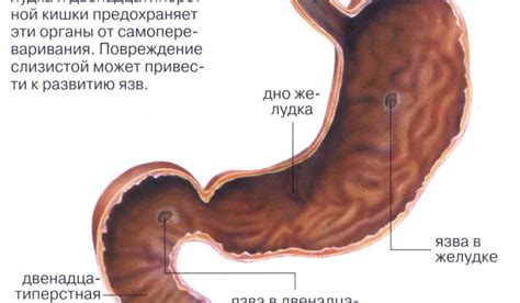 Причины возникновения новообразования желудка