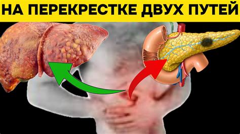 Причины возникновения острых болевых приступов в области печени