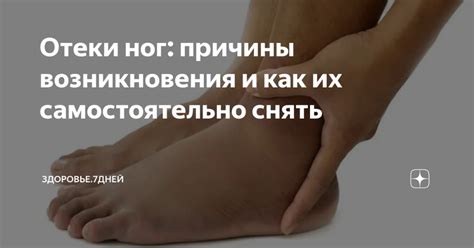 Причины возникновения отечности ног и воздействие длительных перелетов на организм