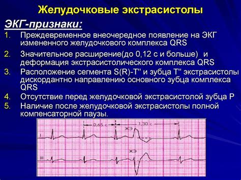 Причины избегать физкультуры при наличии синусовой тахикардии