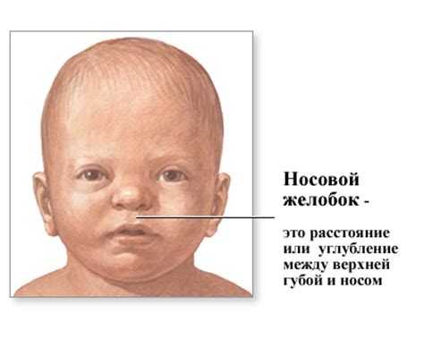 Причины изменения окраски кожи в области между носом и губами у младенцев