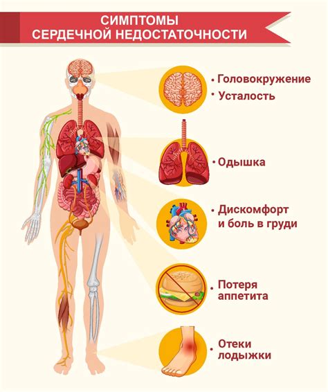 Причины и симптомы вирсунгоэктазии