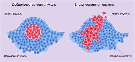 Причины новообразования