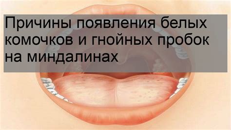 Причины появления гнойных высыпаний на подбородке и их отличительные признаки