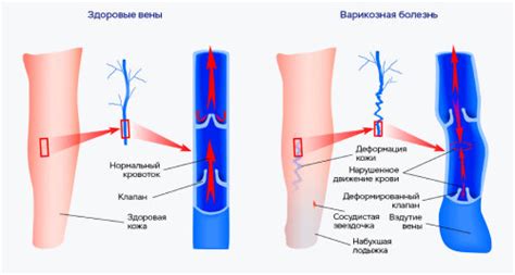 Проблема венозных расстройств