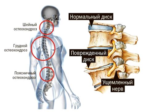 Проблемы, связанные с расположением верхнего отдела позвоночника