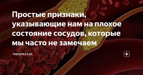 Простые признаки растительности, указывающие на север