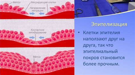 Протеин и процесс заживления язвы: важное взаимодействие