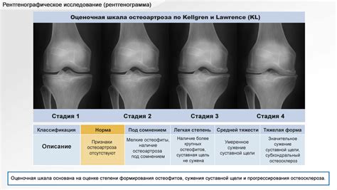 Противопоказания при облучение раздутое сустава и меры, которые следует принять