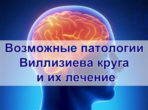 Профилактика Виллизиева круга и поддержание здоровья сосудов