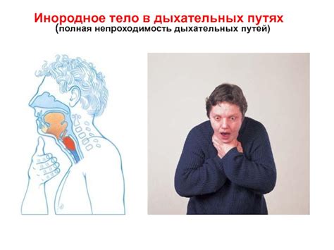 Профилактика и лечение неприятного явления - звука хрипоты, возникающего в дыхательных путях
