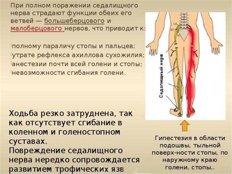 Профилактика повреждений седалищного нерва при введении инъекций в область ягодиц