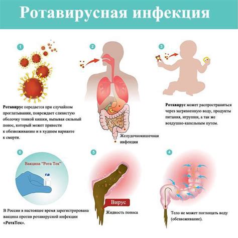 Профилактика ротовирусной инфекции: как предотвратить возникновение заболевания