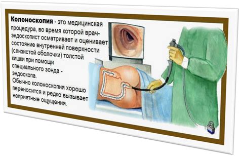 Процесс проведения колоноскопии: этапы и рекомендации