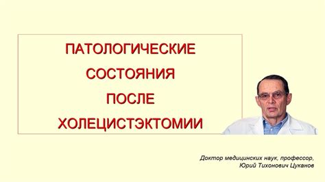 Процесс проколирования при холецистэктомии: подробная инструкция для пациентов