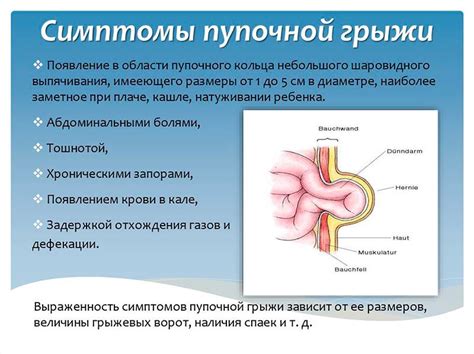 Пупочная грыжа у детей: особенности диагностики