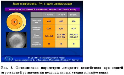 Работа лазерного воздействия при недуге