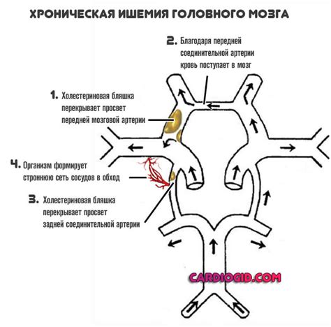 Развитие Виллизиева круга у взрослых