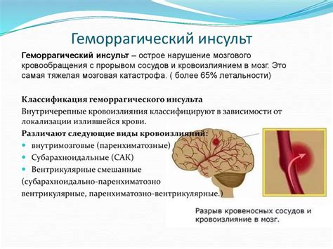 Различия между ишемическим и геморрагическим инсультом