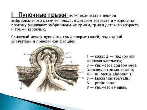 Различные области, в которых могут возникать грыжи у человека