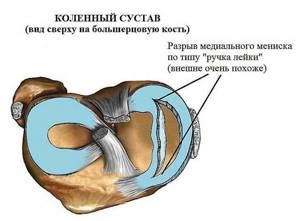 Разнообразие травм и их специфика в структурах коленного сочленения