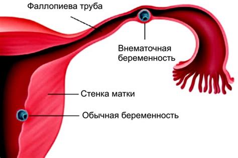 Распределение икринок в маточной полости: ключевые особенности и процессы