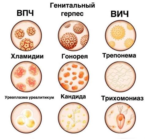 Распространенные заболевания, передаваемые паразитами