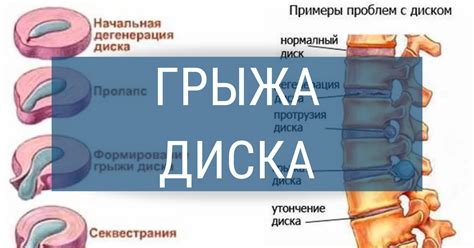 Расстройства зрительной функции - одно из возможных следствий повреждения головы