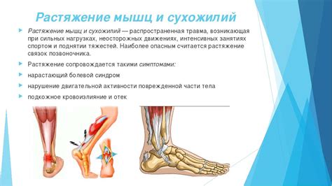 Растяжение мышц и связок как основная причина дискомфорта в покое