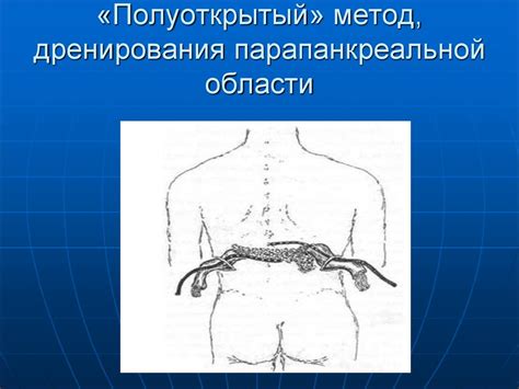 Риски и осложнения процедуры дренирования в области таза