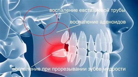 Роль Евстахиевой трубы в организме